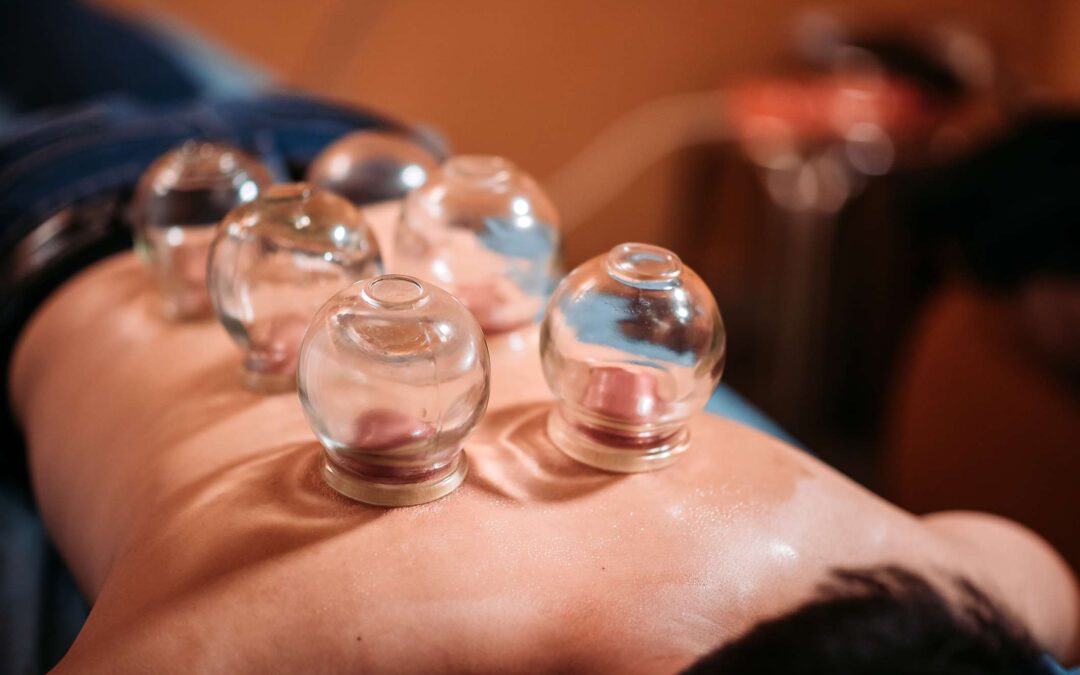 Cupping – What the Cleveland Clinic says…